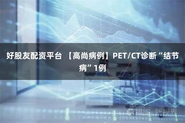 好股友配资平台 【高尚病例】PET/CT诊断“结节病”1例